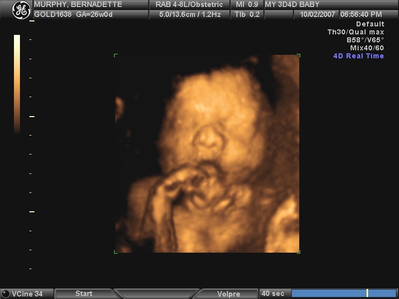 Baby Yawning